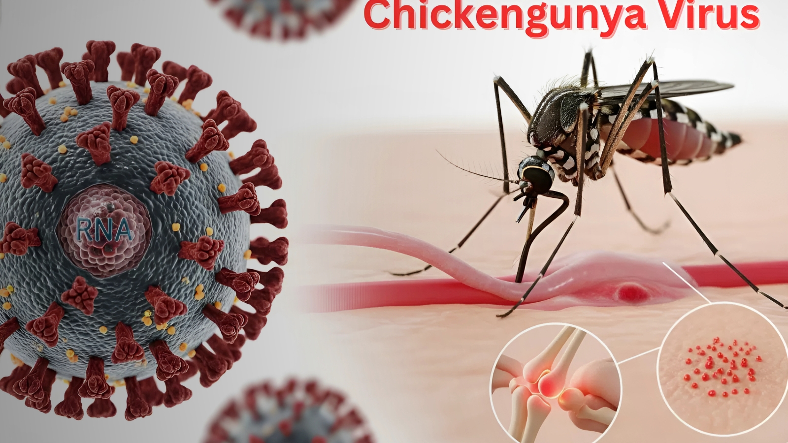 Chikungunya Virus